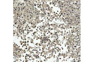 IHC analysis of TBX18 using anti-TBX18 antibody (ABIN7599494).