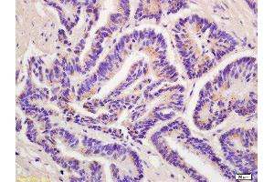 Immunohistochemistry (Paraffin-embedded Sections) (IHC (p)) image for anti-Purinergic Receptor P2x, Ligand-Gated Ion Channel, 3 (P2RX3) (AA 241-340) antibody (ABIN705866)
