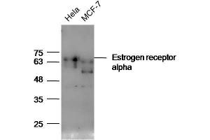 Lane 1: HeLa lysates Lane 2: MCF7 lysates probed with Anti-Estrogen receptor alpha Polyclonal Antibody, Unconjugated  at 1:5000 for 90 min at 37˚C. (Estrogen Receptor alpha 抗体  (AA 241-300))