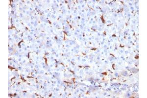Immunohistochemistry (IHC) image for anti-Cathepsin K (CTSK) (AA 163-274) antibody (ABIN6939219)