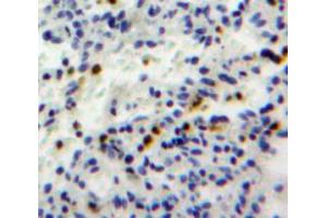 Used in DAB staining on fromalin fixed paraffin-embedded spleen tissue (GZMH 抗体  (AA 19-246))