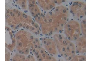 DAB staining on IHC-P; Samples: Human Kidney Tissue (MMP14 抗体  (AA 112-321))
