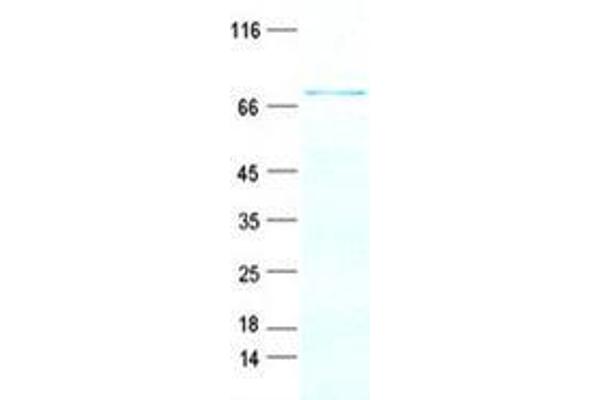 Kyphoscoliosis Peptidase Protein (KY) (His tag)