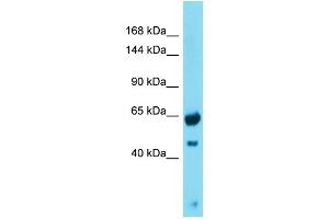 Western Blotting (WB) image for anti-Growth Regulation By Estrogen in Breast Cancer 1 (GREB1) (N-Term) antibody (ABIN2774550) (GREB1 抗体  (N-Term))