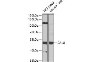 Western blot analysis of extracts of various cell lines, using CALU antibody (ABIN6129533, ABIN6137878, ABIN6137880 and ABIN6222201) at 1:1000 dilution. (CALU 抗体  (AA 20-315))