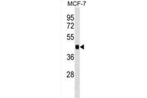 Western Blotting (WB) image for anti-Immediate Early Response 5 (IER5) antibody (ABIN2999398) (IER5 抗体)