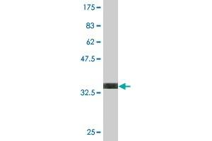 Western Blot detection against Immunogen (35. (DLX6 抗体  (AA 71-160))