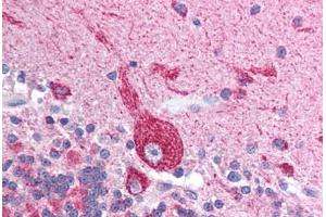 Immunohistochemistry (IHC) image for anti-Voltage-Dependent Anion Channel 2 (VDAC2) (N-Term) antibody (ABIN6736446)