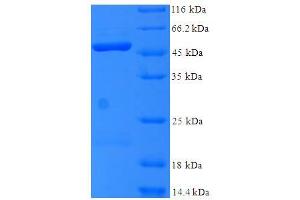 SDS-PAGE (SDS) image for Mitochondrial Ribosomal Protein L1 (MRPL1) (AA 51-324), (partial) protein (His-SUMO Tag) (ABIN5711849)