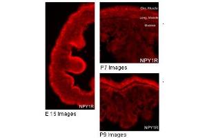 Immunohistochemistry with gut tissue (NPY1R 抗体  (Middle Region))