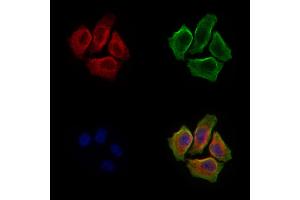 ABIN6260382 and ABIN6279246 staining Hela cells by IF/ICC. (CA7 抗体  (C-Term))