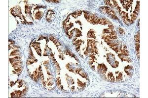 Immunohistochemical staining of paraffin-embedded Human prostate tissue using anti-PANK2 mouse monoclonal antibody. (PANK2 抗体)