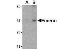 Western blot analysis of Emerin in human skeletal muscle tissue lysate with AP30313PU-N Emerin antibody at (A) 0. (Emerin 抗体  (N-Term))