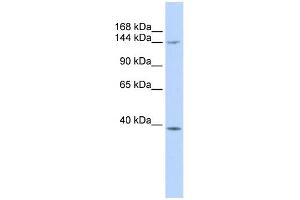 WB Suggested Anti-SMC4 Antibody Titration:  0. (SMC4 抗体  (Middle Region))