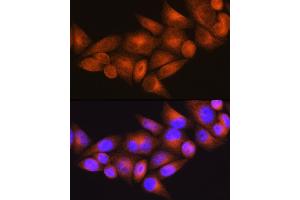 Immunofluorescence analysis of HeLa cells using WFS1 Rabbit pAb (ABIN3022419, ABIN3022420, ABIN1513689, ABIN1514834 and ABIN6218806) at dilution of 1:100 (40x lens).