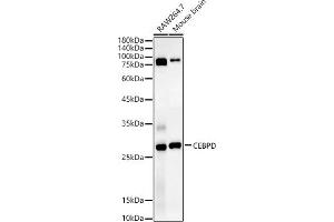 Western blot analysis of extracts of various cell lines, using CEBPD antibody (ABIN7266160) at 1:1340 dilution. (CEBPD 抗体  (AA 1-269))
