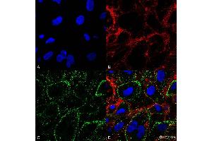 Immunocytochemistry/Immunofluorescence analysis on non-permeabilized HCT116 cells using Mouse Anti-HSP70 Monoclonal Antibody, Clone 1H11: FITC conjugate  showing cell membrane staining. (HSP70 抗体  (Atto 488))