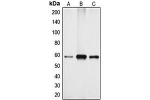 Western blot analysis of Cytochrome P450 4X1 expression in Jurkat (A), mouse kidney (B), rat kidney (C) whole cell lysates. (CYP4X1 抗体  (Center))
