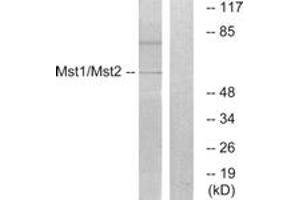Western blot analysis of extracts from HeLa cells, treated with UV 15', using Mst1/2 (Ab-183) Antibody. (MST1/MST2 (AA 149-198) 抗体)