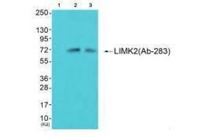 Western blot analysis of extracts from 293 cells (Lane 2) and cos-7 cells (Lane 3), using LIMK2 (Ab-283) antiobdy. (LIMK2 抗体  (Ser283))
