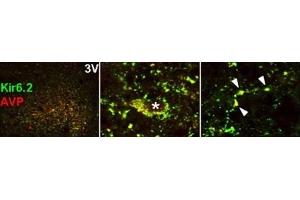 anti-Potassium Inwardly-Rectifying Channel, Subfamily J, Member 11 (KCNJ11) (AA 372-385), (Intracellular) antibody