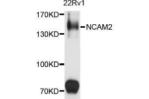 Western blot analysis of extracts of 22Rv1 cells, using NCAM2 antibody (ABIN5972146) at 1/1000 dilution. (NCAM2 抗体)