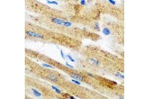 Immunohistochemical analysis of GPAM staining in mouse heart formalin fixed paraffin embedded tissue section. (GPAM 抗体)