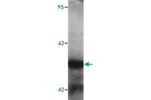 Western blot analysis of human kidney tissue lysate with TTYH2 polyclonal antibody  at 1 ug/mL. (TTYH2 抗体  (N-Term))