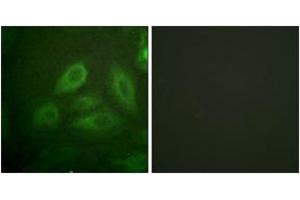Immunofluorescence analysis of HeLa cells, using DRP-2 (Phospho-Thr514) Antibody. (DRP2 抗体  (pThr514))