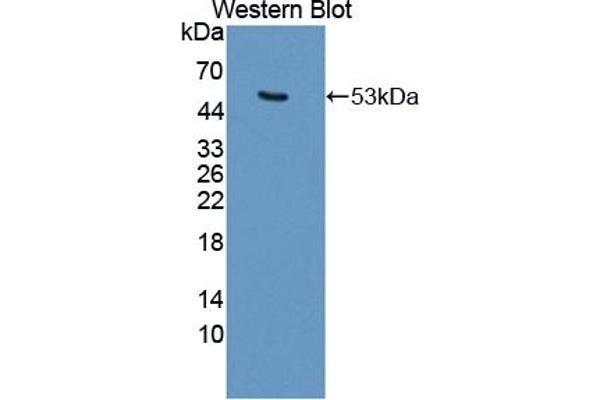 Keratin 25 Antikörper  (AA 1-446)