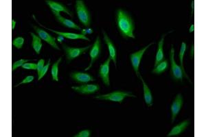 Immunofluorescence staining of Hela cells with ABIN7169088 at 1:100, counter-stained with DAPI. (NEK1 抗体  (AA 626-809))