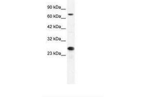 Image no. 2 for anti-Minichromosome Maintenance Complex Component 6 (MCM6) (C-Term) antibody (ABIN202926)