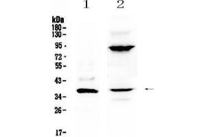 Western blot analysis of IL12B using anti-IL12B antibody . (IL12B 抗体  (AA 23-253))