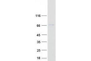 Western Blotting (WB) image for Baculoviral IAP Repeat Containing 2 (BIRC2) protein (Myc-DYKDDDDK Tag) (ABIN2723209)