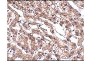 Immunohistochemistry of MACC1 in human liver tissue with this product at 2. (MACC1 抗体  (Center))