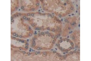 IHC-P analysis of Human Tissue, with DAB staining. (IL21 Receptor 抗体  (AA 23-185))