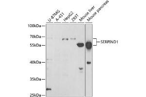 Western blot analysis of extracts of various cell lines, using SERPIND1 antibody (ABIN6131316, ABIN6147598, ABIN6147599 and ABIN6221548) at 1:1000 dilution. (SERPIND1 抗体  (AA 20-290))