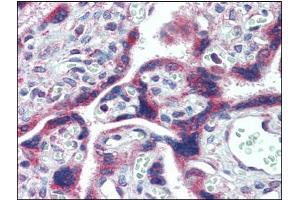 Immunohistochemistry Image: Human Placenta: Formalin-Fixed, Paraffin-Embedded (FFPE) (FMR1 抗体  (C-Term, Internal Region))