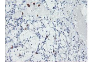 Image no. 2 for anti-Ubiquitin Specific Peptidase 36 (USP36) (AA 589-972) antibody (ABIN1491604) (USP36 抗体  (AA 589-972))