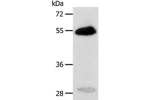 Western Blot analysis of Human liver cancer tissue using CA14 Polyclonal Antibody at dilution of 1:400 (CA14 抗体)