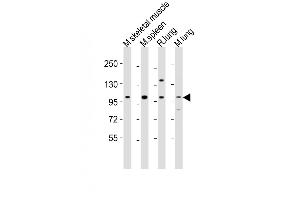 All lanes : Anti-Fgfr4 Antibody (Center) at 1:2000 dilution Lane 1: mouse skeletal muscle lysates Lane 2: mouse spleen lysates Lane 3: rat lung lysates Lane 4: mouse lung lysates Lysates/proteins at 20 μg per lane. (FGFR4 抗体  (AA 448-482))