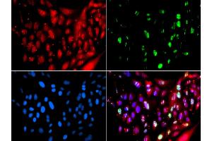 Immunofluorescence analysis of GFP-RNF168 transgenic U2OS cells using UIMC1 antibody (ABIN6128891, ABIN6149915, ABIN6149916 and ABIN6223082). (UIMC1 抗体  (AA 1-230))
