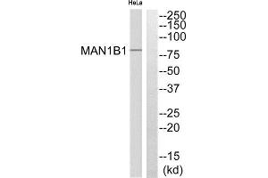 Western Blotting (WB) image for anti-Mannosidase, Alpha, Class 1B, Member 1 (MAN1B1) (Internal Region) antibody (ABIN1851304) (MAN1B1 抗体  (Internal Region))
