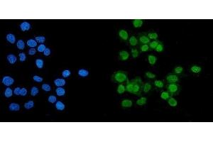 IF analysis of PARP using anti-PARP antibody (ABIN7602276). (PARP1 抗体  (AA 670-858))