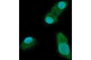 IF analysis of YTHDC2 using anti-YTHDC2 antibody (ABIN7599661). (YTHDC2 抗体  (AA 105-1231))