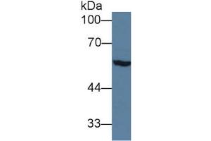 Rabbit Detection antibody from the kit in WB with Positive Control: Sample Rat serum.