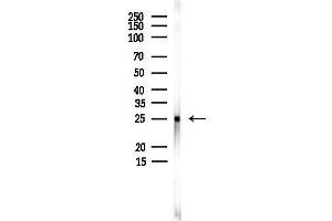 Western blot analysis of lysates from PC12 cells(heat-shock,45 min treatment), using CHMP4C Antibody at 1/1000 dilution.