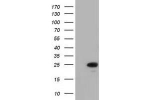 Western Blotting (WB) image for anti-MOB Kinase Activator 3B (MOB3B) antibody (ABIN1499537) (MOBKL2B 抗体)