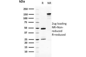SDS-PAGE (SDS) image for anti-serpin Peptidase Inhibitor, Clade B (Ovalbumin), Member 3 (SERPINB3) antibody (ABIN6940565)