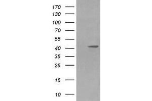 Image no. 6 for anti-Mitogen-Activated Protein Kinase Kinase 1 (MAP2K1) antibody (ABIN1499394) (MEK1 抗体)